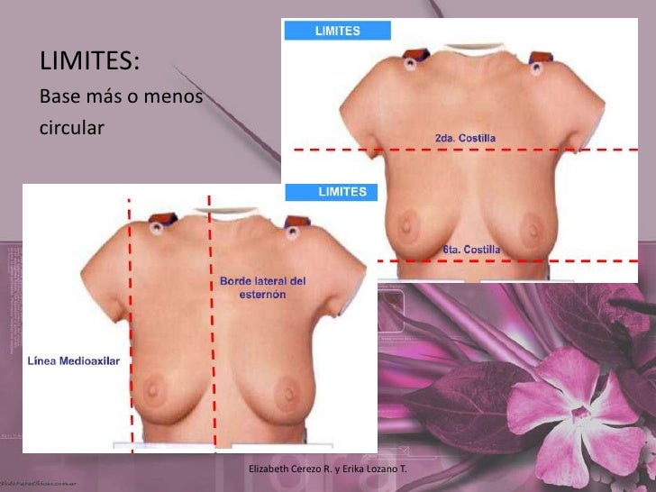 condicion fibroquistica de seno